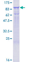 MX1 / MX Protein - 12.5% SDS-PAGE of human MX1 stained with Coomassie Blue
