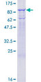 MX1 / MX Protein - 12.5% SDS-PAGE of human MX1 stained with Coomassie Blue