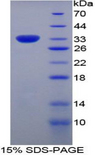 MX1 / MX Protein - Recombinant Myxovirus Resistance 1 By SDS-PAGE