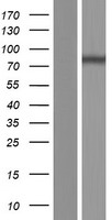 MX2 Protein - Western validation with an anti-DDK antibody * L: Control HEK293 lysate R: Over-expression lysate