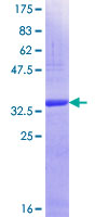 MX2 Protein - 12.5% SDS-PAGE Stained with Coomassie Blue.