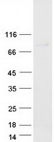 MX2 Protein - Purified recombinant protein MX2 was analyzed by SDS-PAGE gel and Coomassie Blue Staining