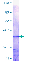 MXD1 / MAD1 Protein - 12.5% SDS-PAGE Stained with Coomassie Blue.