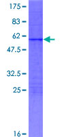 MXD3 / MAD3 Protein - 12.5% SDS-PAGE of human MXD3 stained with Coomassie Blue