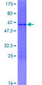 MXD3 / MAD3 Protein - 12.5% SDS-PAGE of human MXD3 stained with Coomassie Blue