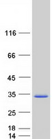 MXD3 / MAD3 Protein - Purified recombinant protein MXD3 was analyzed by SDS-PAGE gel and Coomassie Blue Staining