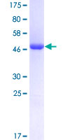 MXI1 / MAD2 Protein - 12.5% SDS-PAGE of human MXI1 stained with Coomassie Blue