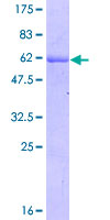 MXI1 / MAD2 Protein - 12.5% SDS-PAGE of human MXI1 stained with Coomassie Blue
