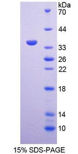 MXRA5 Protein - Recombinant  Matrix Remodelling Associated Protein 5 By SDS-PAGE