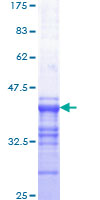 MYB / c-Myb Protein - 12.5% SDS-PAGE Stained with Coomassie Blue.