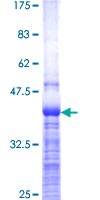 MYBBP1A Protein - 12.5% SDS-PAGE Stained with Coomassie Blue.