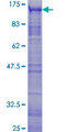MYBL2 Protein - 12.5% SDS-PAGE of human MYBL2 stained with Coomassie Blue