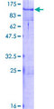 MYBL2 Protein - 12.5% SDS-PAGE of human MYBL2 stained with Coomassie Blue