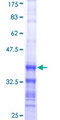 MYBL2 Protein - 12.5% SDS-PAGE Stained with Coomassie Blue.