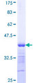 MYBPC1 Protein - 12.5% SDS-PAGE Stained with Coomassie Blue.