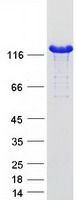 MYBPC1 Protein - Purified recombinant protein MYBPC1 was analyzed by SDS-PAGE gel and Coomassie Blue Staining