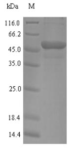 MYBPC2 Protein - (Tris-Glycine gel) Discontinuous SDS-PAGE (reduced) with 5% enrichment gel and 15% separation gel.
