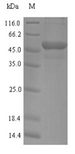 MYBPC2 Protein - (Tris-Glycine gel) Discontinuous SDS-PAGE (reduced) with 5% enrichment gel and 15% separation gel.