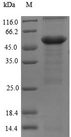 MYBPC3 / MYBP-C Protein - (Tris-Glycine gel) Discontinuous SDS-PAGE (reduced) with 5% enrichment gel and 15% separation gel.