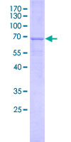 MYBPHL Protein - 12.5% SDS-PAGE Stained with Coomassie Blue