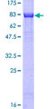 MYC / c-Myc Protein - 12.5% SDS-PAGE of human MYC stained with Coomassie Blue