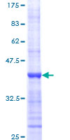 MYC / c-Myc Protein - 12.5% SDS-PAGE Stained with Coomassie Blue.