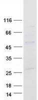 MYC / c-Myc Protein - Purified recombinant protein MYC was analyzed by SDS-PAGE gel and Coomassie Blue Staining
