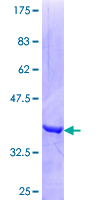 MYCBP Protein - 12.5% SDS-PAGE Stained with Coomassie Blue.