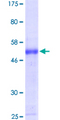 MYCL / L-Myc Protein - 12.5% SDS-PAGE of human MYCL1 stained with Coomassie Blue