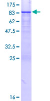 MYCN / N-myc Protein - 12.5% SDS-PAGE of human MYCN stained with Coomassie Blue