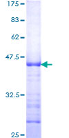 MYCN / N-myc Protein - 12.5% SDS-PAGE Stained with Coomassie Blue.