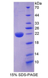 MYD118 / GADD45B Protein - Recombinant Growth Arrest And DNA Damage Inducible Protein Beta By SDS-PAGE