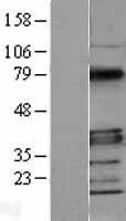 MYD88 Protein - Western validation with an anti-DDK antibody * L: Control HEK293 lysate R: Over-expression lysate