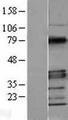 MYD88 Protein - Western validation with an anti-DDK antibody * L: Control HEK293 lysate R: Over-expression lysate