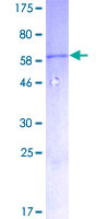 MYD88 Protein - 12.5% SDS-PAGE of human MYD88 stained with Coomassie Blue