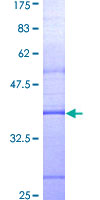 MYD88 Protein - 12.5% SDS-PAGE Stained with Coomassie Blue.