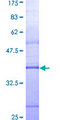 MYD88 Protein - 12.5% SDS-PAGE Stained with Coomassie Blue.