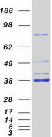 MYD88 Protein - Purified recombinant protein MYD88 was analyzed by SDS-PAGE gel and Coomassie Blue Staining