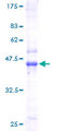 MYDGF / SF20 Protein - 12.5% SDS-PAGE of human C19orf10 stained with Coomassie Blue