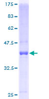 MYDGF / SF20 Protein - 12.5% SDS-PAGE of human C19orf10 stained with Coomassie Blue