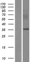 MYEOV Protein - Western validation with an anti-DDK antibody * L: Control HEK293 lysate R: Over-expression lysate