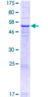MYEOV Protein - 12.5% SDS-PAGE of human MYEOV stained with Coomassie Blue