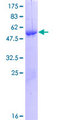 MYF6 / MRF4 Protein - 12.5% SDS-PAGE of human MYF6 stained with Coomassie Blue
