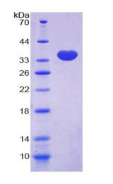 MYH10 Protein - Recombinant Myosin Heavy Chain 10, Non Muscle By SDS-PAGE