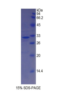 MYH14 Protein - Recombinant Myosin Heavy Chain 14, Non Muscle By SDS-PAGE