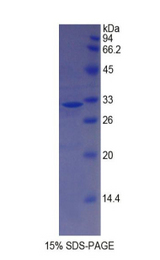 MYH14 Protein - Recombinant Myosin Heavy Chain 14, Non Muscle By SDS-PAGE