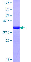 MYH16 Protein - 12.5% SDS-PAGE Stained with Coomassie Blue.