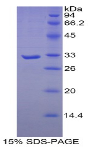 MYH16 Protein - Recombinant Myosin Heavy Chain 16 By SDS-PAGE