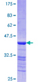 MYH3 Protein - 12.5% SDS-PAGE Stained with Coomassie Blue.