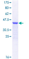 MYH7 Protein - 12.5% SDS-PAGE Stained with Coomassie Blue.